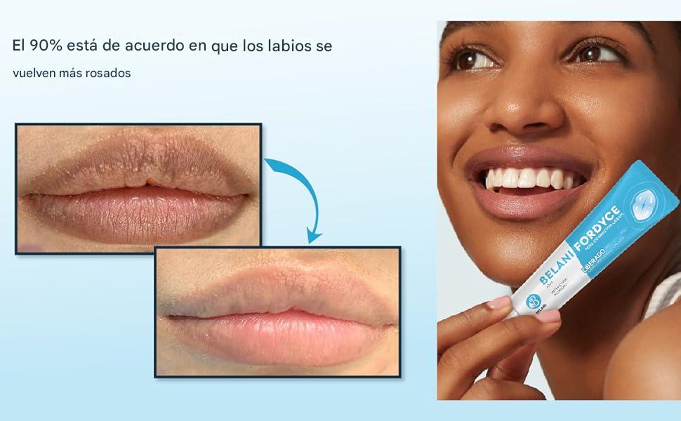 💥 ¡Despídete de las manchas de Fordyce y dile🧴HOLA a unos labios suaves perfectos! 👄✨